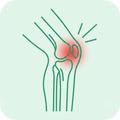 Knee Pain